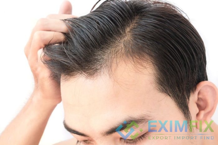 Hair Transplantation